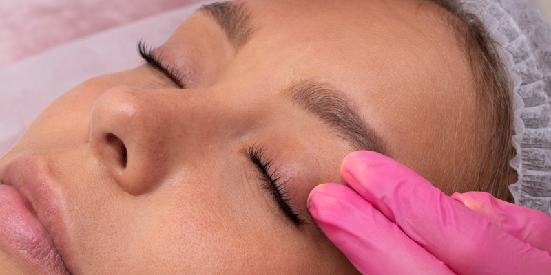 Brow-Lift-Melbourne