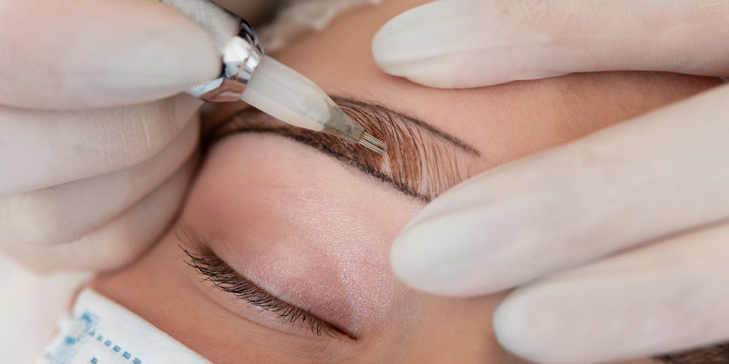Brow-Lift-Services-in-Melbourne